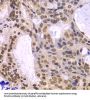 DNA Polymerase Delta 3, Accessory Subunit (POLD3) Antibody
