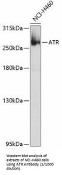 Serine/Threonine-Protein Kinase ATR (ATR) Antibody