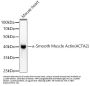 Actin Alpha 2, Smooth Muscle (ACTA2) Antibody