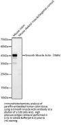Actin Alpha 2, Smooth Muscle (ACTA2) Antibody