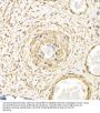 Actin Alpha 2, Smooth Muscle (ACTA2) Antibody