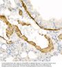 Actin Alpha 2, Smooth Muscle (ACTA2) Antibody