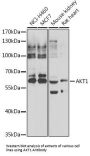 RAC-Alpha Serine/threonine-Protein Kinase (AKT1) Antibody