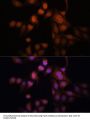 Twist-Related Protein 1 (TWIST1) Antibody