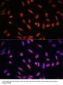 Twist-Related Protein 1 (TWIST1) Antibody
