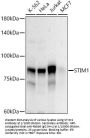 Stromal Interaction Molecule 1 (STIM1) Antibody