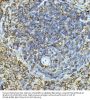 B-Cell Antigen Receptor Complex-Associated Protein Alpha Chain (CD79A) Antibody