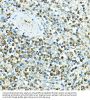 B-Cell Antigen Receptor Complex-Associated Protein Alpha Chain (CD79A) Antibody
