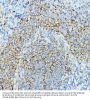 B-Cell Antigen Receptor Complex-Associated Protein Alpha Chain (CD79A) Antibody