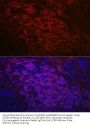 B-Cell Antigen Receptor Complex-Associated Protein Alpha Chain (CD79A) Antibody