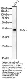 Leukocyte Antigen G (HLA-G) Antibody