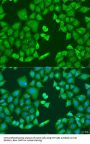 Cytochrome P450 11B1 (CYP11B1) Antibody