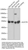 Glycerate Kinase (GLYCTK) Antibody