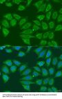Alcohol Dehydrogenase Class 4 Mu/Sigma Chain (ADH7) Antibody