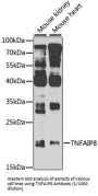 Tumor Necrosis Factor, Alpha-Induced Protein 8 (TNFAIP8) Antibody