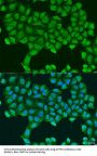 ATP Synthase Subunit O, Mitochondrial (ATP5O) Antibody