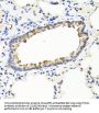 Interferon Omega-1 (IFNW1) Antibody