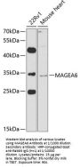 Melanoma-Associated Antigen 6 (MAGEA6) Antibody