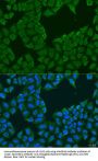 Melanoma-Associated Antigen 6 (MAGEA6) Antibody