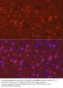 Synaptotagmin 11 (SYT11) Antibody