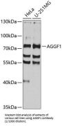 Angiogenic Factor With G Patch And FHA Domains 1 (AGGF1) Antibody