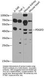 Platelet Derived Growth Factor D (PDGFD) Antibody