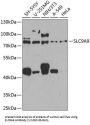 Sodium/hydrogen Exchanger 9 (SLC9A9) Antibody