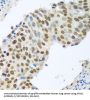 Mediator Of DNA Damage Checkpoint 1 (MDC1) Antibody