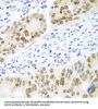 Mediator Of DNA Damage Checkpoint 1 (MDC1) Antibody