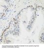 Mediator Of DNA Damage Checkpoint 1 (MDC1) Antibody