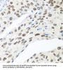 Mediator Of DNA Damage Checkpoint 1 (MDC1) Antibody