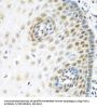 Mediator Of DNA Damage Checkpoint 1 (MDC1) Antibody