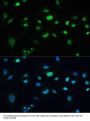 Mediator Of DNA Damage Checkpoint 1 (MDC1) Antibody
