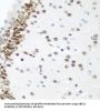 Ubiquitin-Conjugating Enzyme E2 U (UBE2U) Antibody