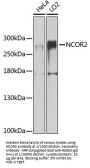 Nuclear Receptor Corepressor 2 (NCOR2) Antibody