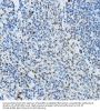 Nuclear Receptor Corepressor 2 (NCOR2) Antibody
