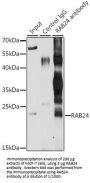 RAB24, Member RAS Oncogene Family (RAB24) Antibody