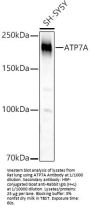 ATPase Copper Transporting Alpha (ATP7A) Antibody
