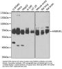 Heterogeneous Nuclear Ribonucleoprotein L (HNRNPL) Antibody