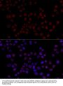 Heterogeneous Nuclear Ribonucleoprotein L (HNRNPL) Antibody