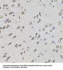 Forkhead Box Protein O3 (FOXO3) Antibody
