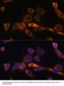 Forkhead Box Protein O3 (FOXO3) Antibody
