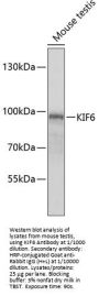 Kinesin-Like Protein KIF6 (KIF6) Antibody