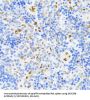 DExD-Box Helicase 39B (DDX39B) Antibody