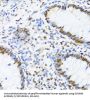 DExD-Box Helicase 39B (DDX39B) Antibody