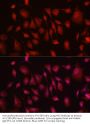 Hexokinase 3 (HK3) Antibody