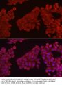 Hexokinase 3 (HK3) Antibody