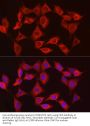 Hexokinase 3 (HK3) Antibody