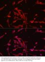 Hexokinase 3 (HK3) Antibody