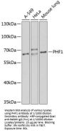 PHD Finger Protein 1 (PHF1) Antibody